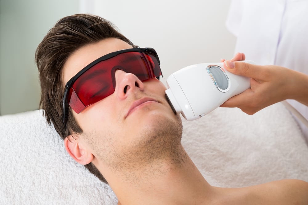 Chin Laser Hair Removal For Men