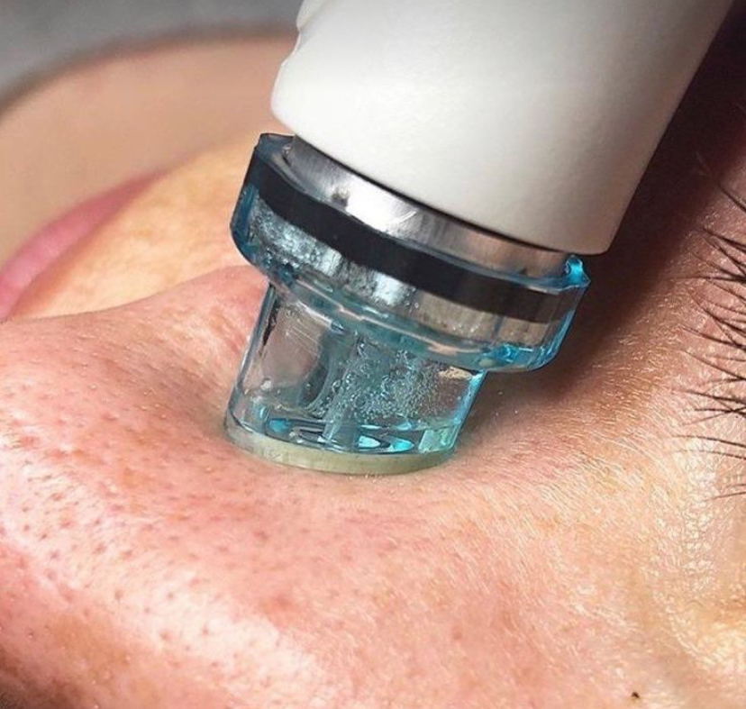 Hydro Glow Facial