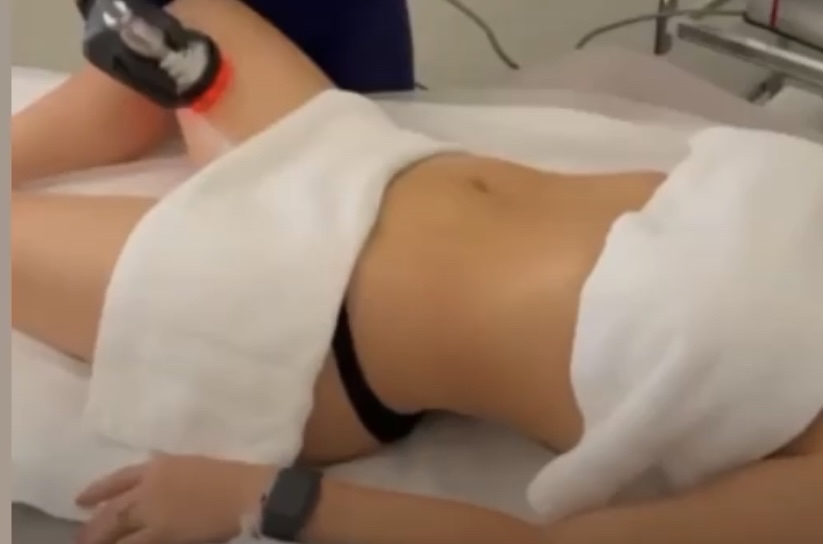 Lipo Cavitation Recurring