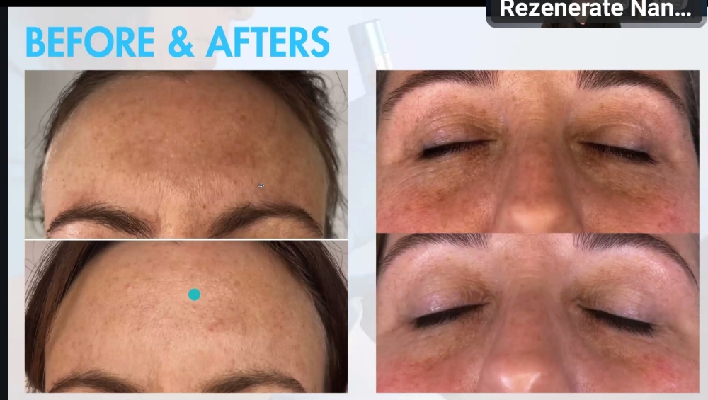 NANO Channeling ~INFUSION