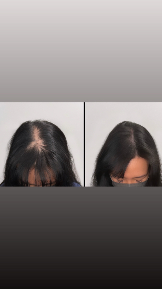 Women’s Scalp Microshading