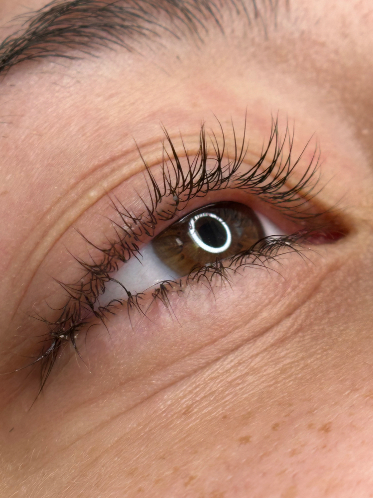 Lash Removal