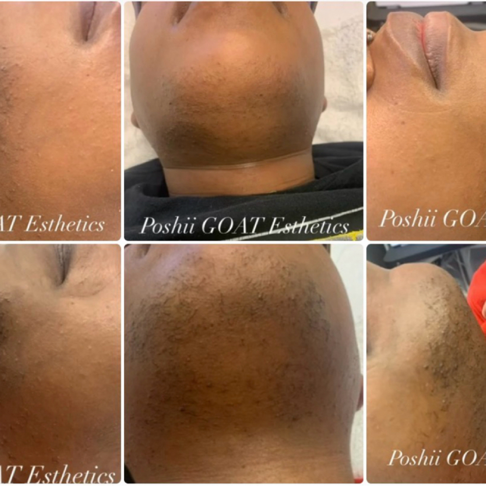Face Waxing at Poshii GOAT Esthetics in Carmel, IN