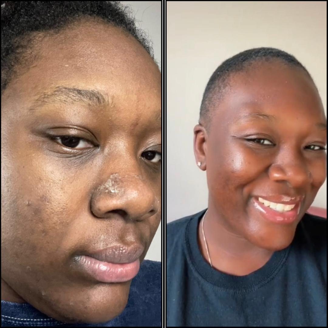 Detox Facial at Reona Spa in Gretna, LA