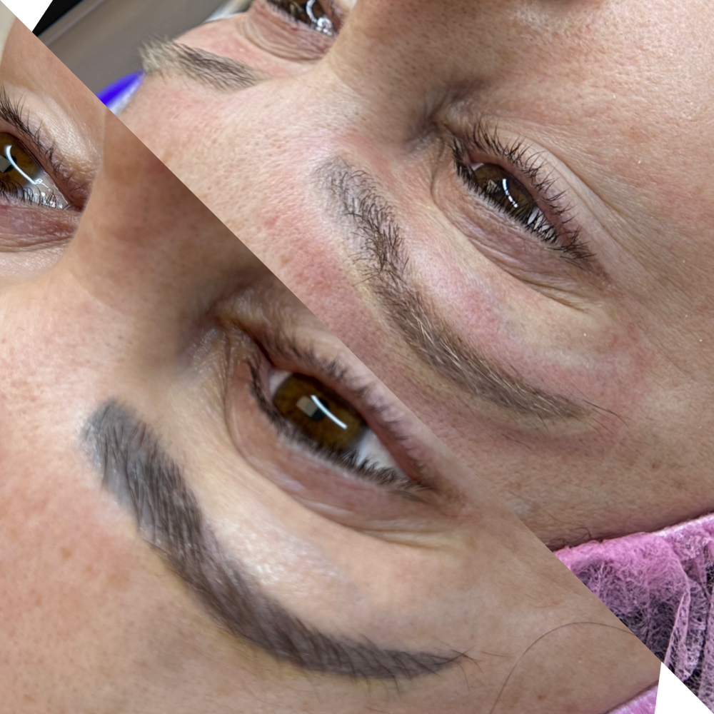 Microblading Laser Removal Promocao