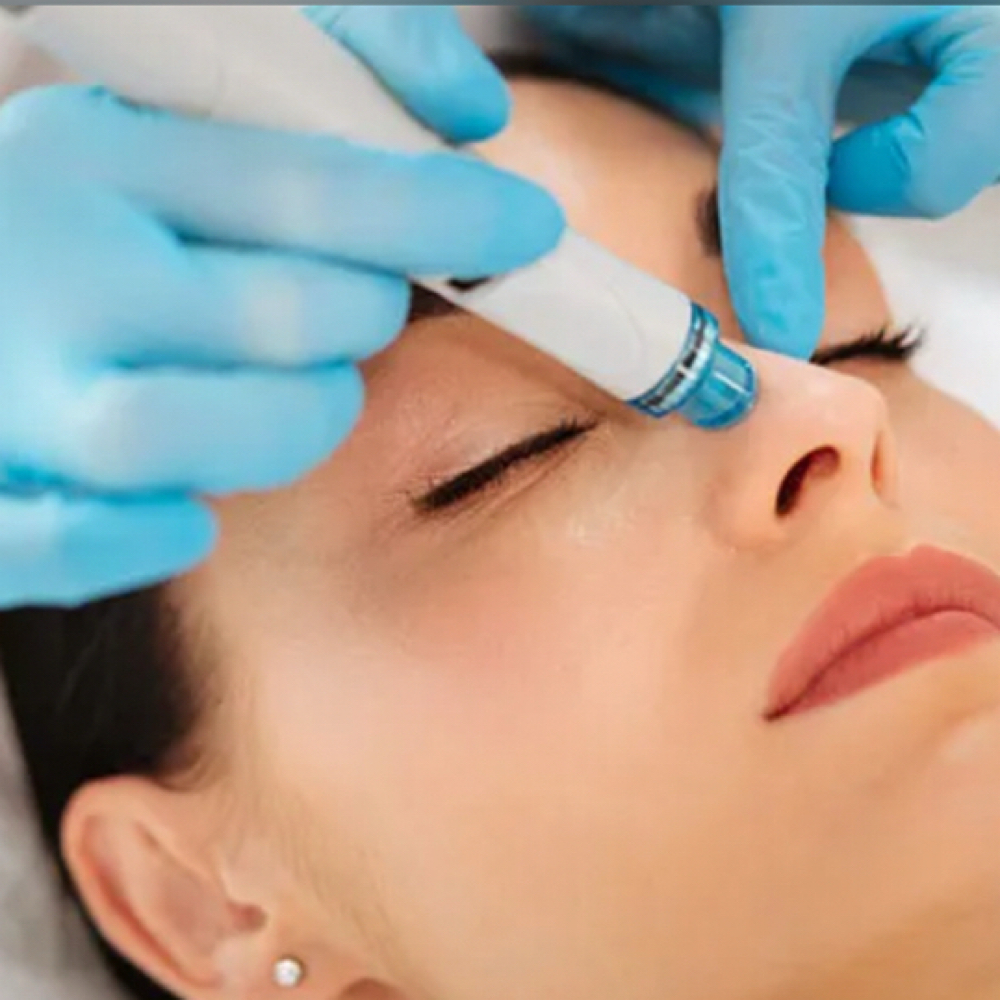 Hydrafacial at Hair Horizons in Schaumburg, IL