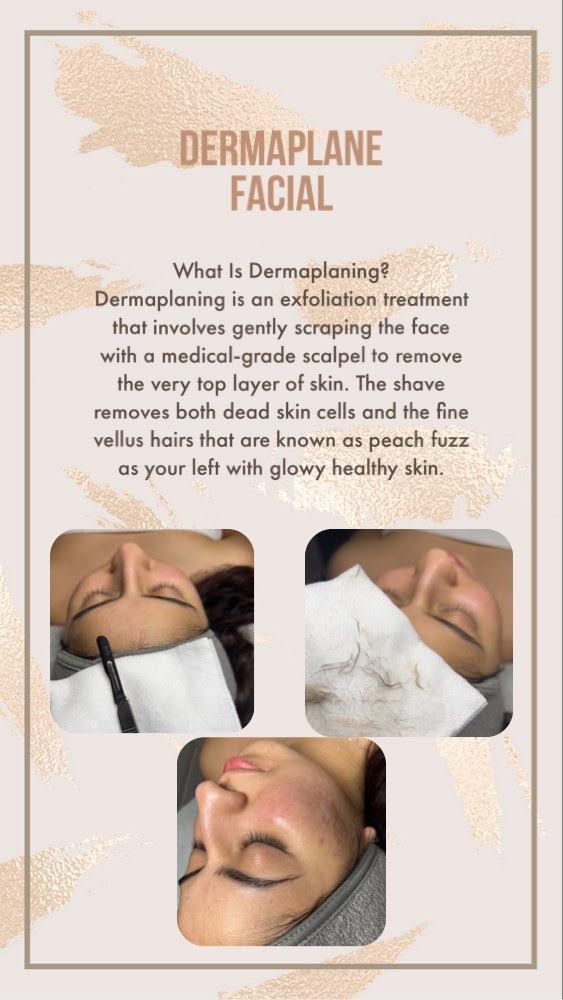 Facial Dermaplaning