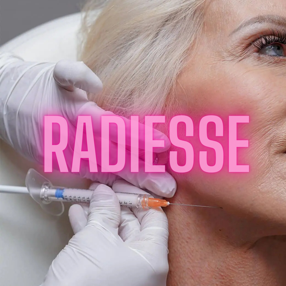 Radiesse at The Aesthetics Boutique in Ellisville, MO