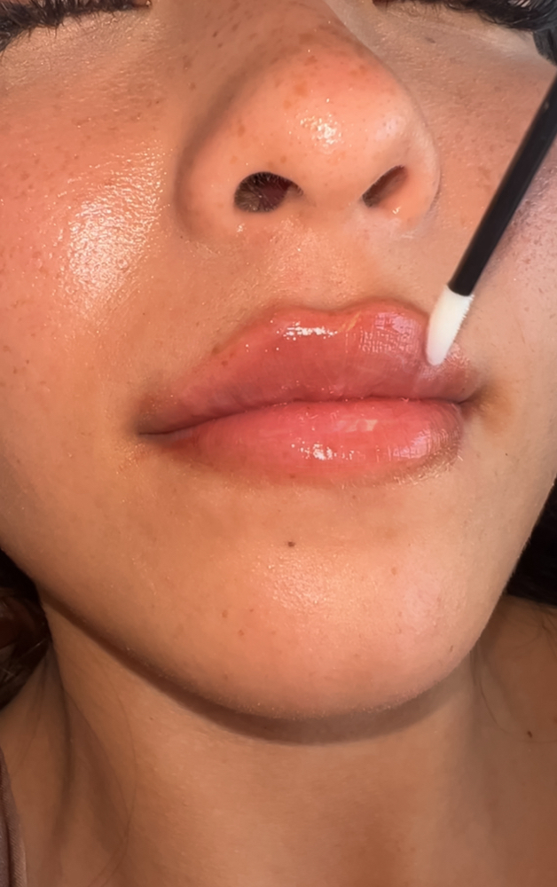 Lip Design- Filler