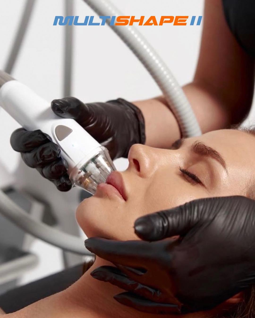 Face and Chin Treatment Add-on
