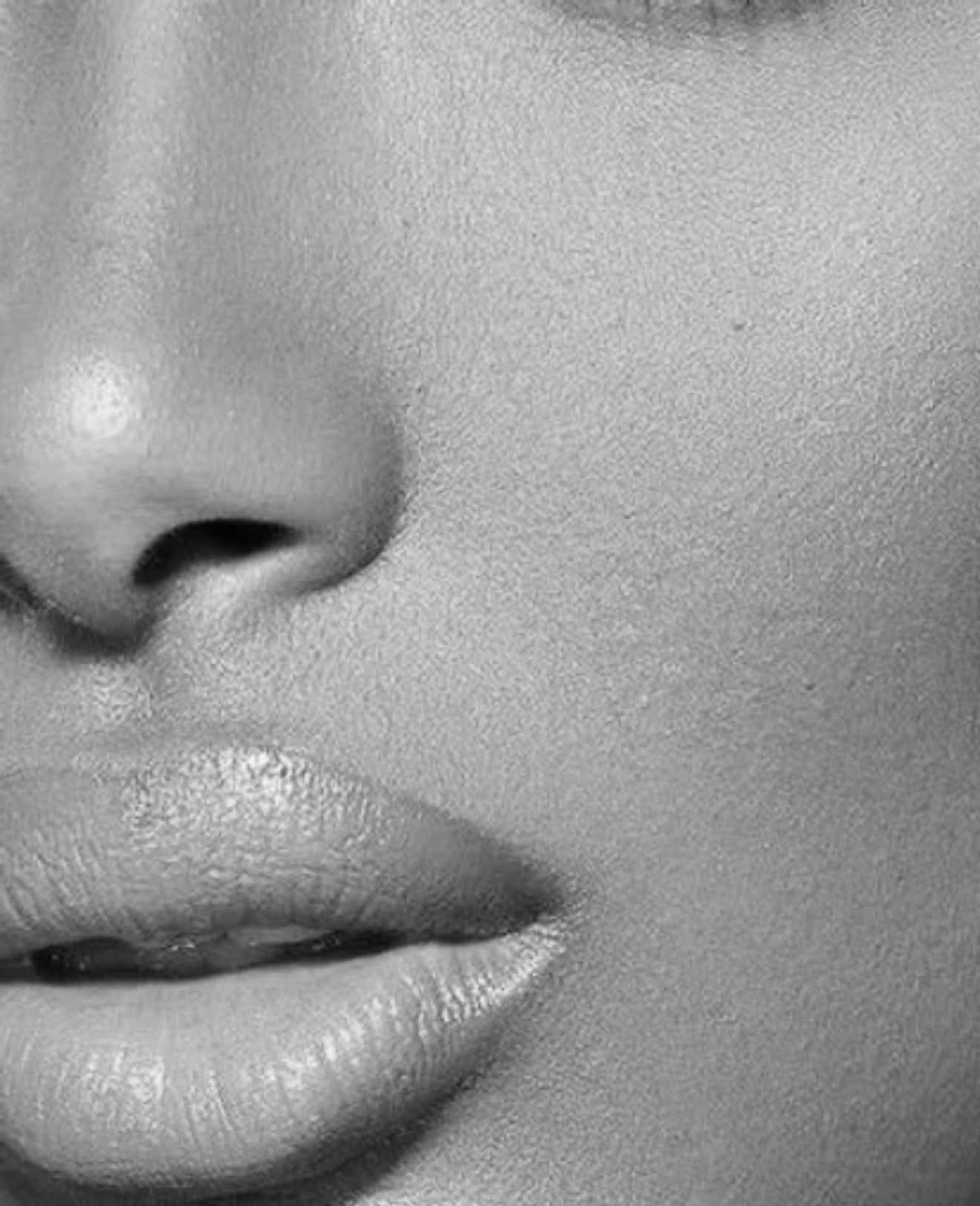 Nose