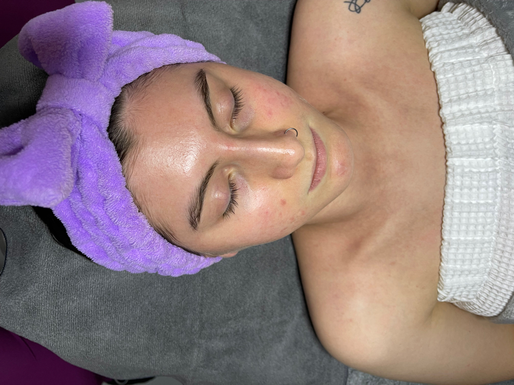 Oxygen Facial