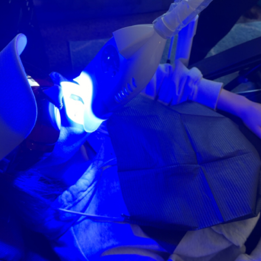 The Mini Whitening at Timeless Glow MN in St Cloud, MN