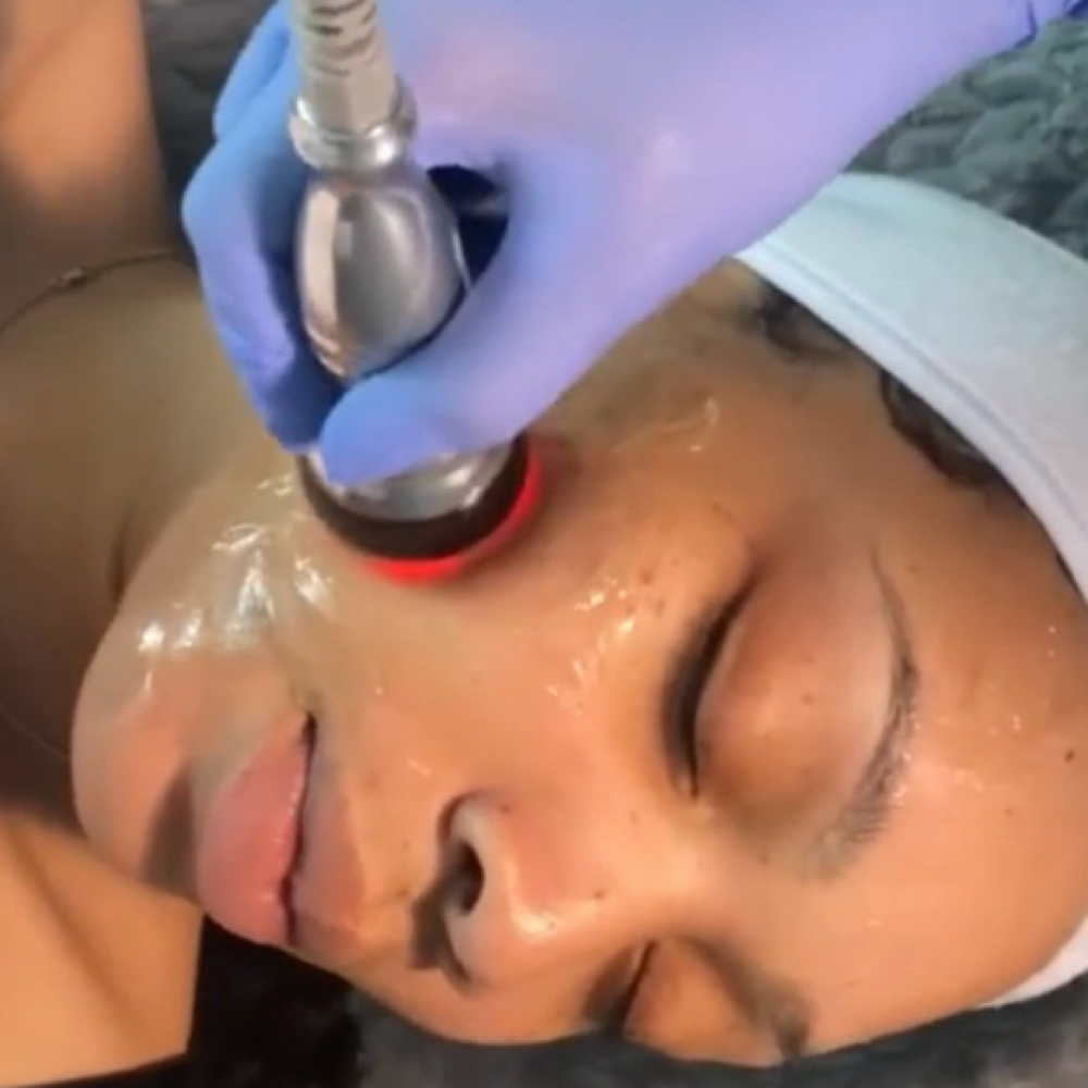 Radio Frequency Package at Eyecandy Salon Suites in Athens, OH