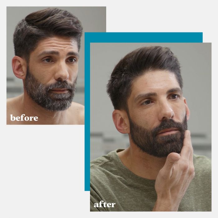 Beard color and tone