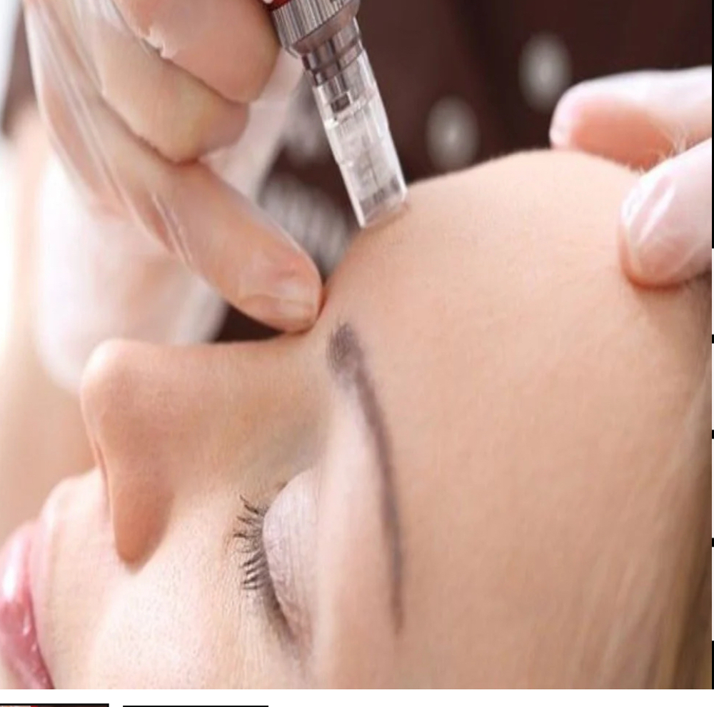 Microneedling at DVASH AESTHETICS in Harlingen, TX