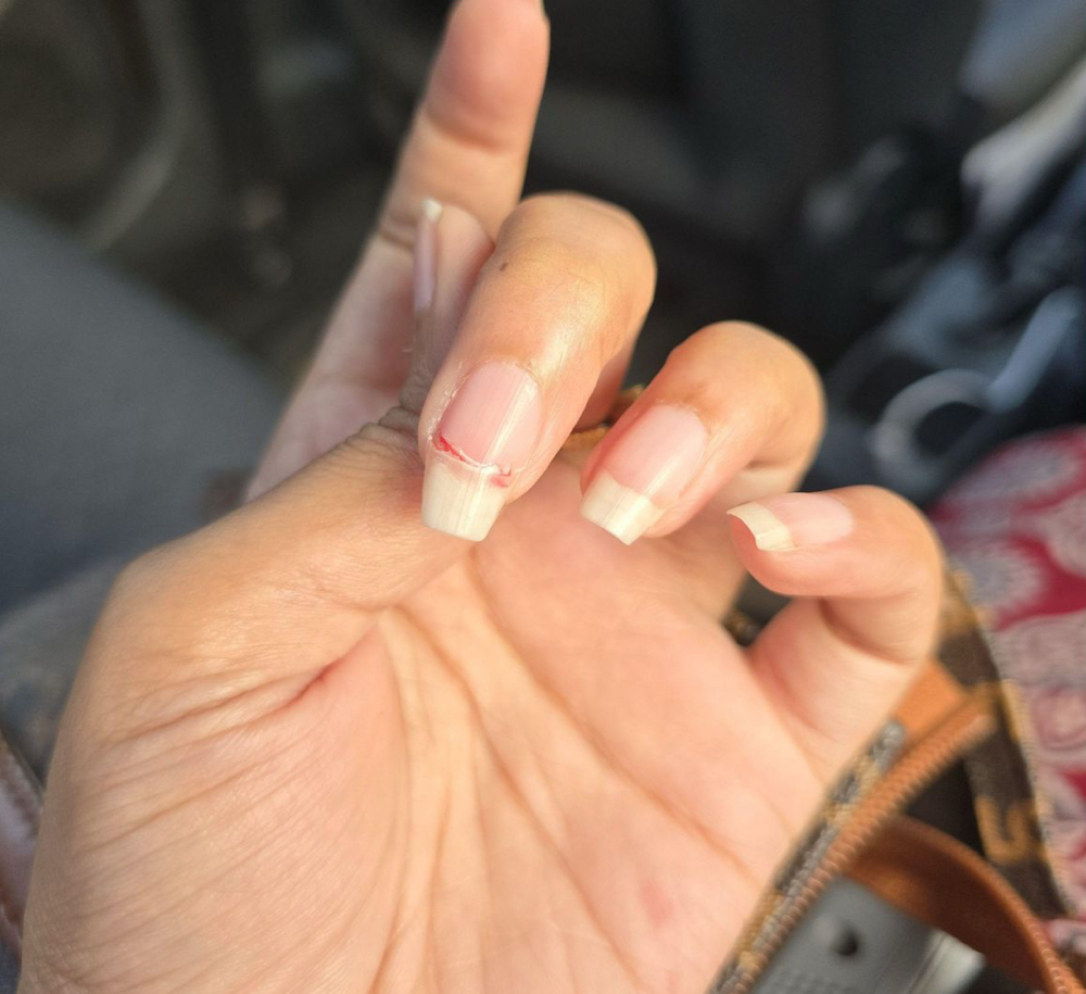 Nail Repair