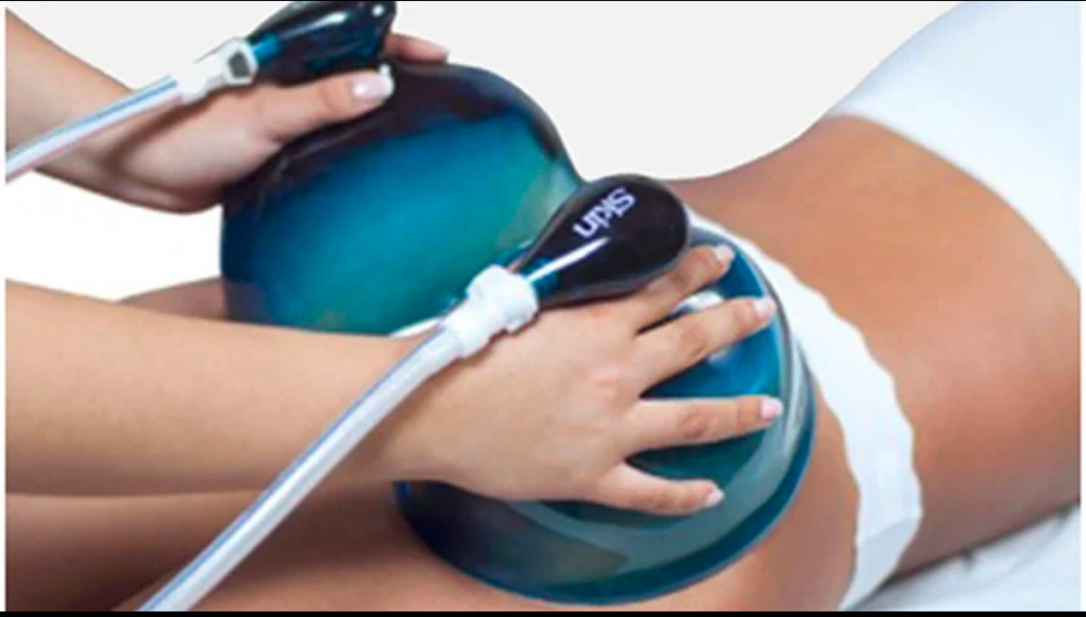 Brazilian Butt Vacuum