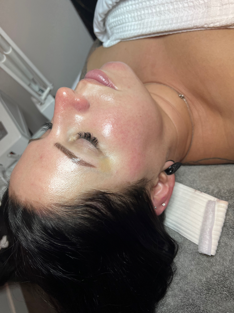 Hydroglow Facial