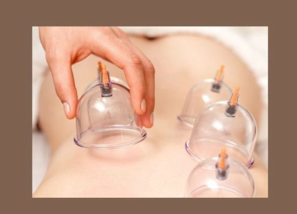 Cupping Therapy- Massage Add On