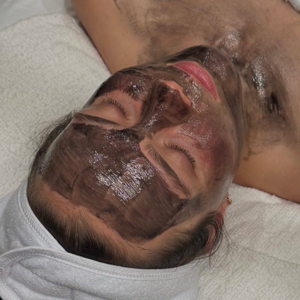Acne Clearing Program at SKIN BY HAYLEE in Rochester, MN