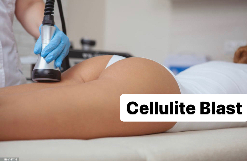 $220 Deep Cellulite Treatment
