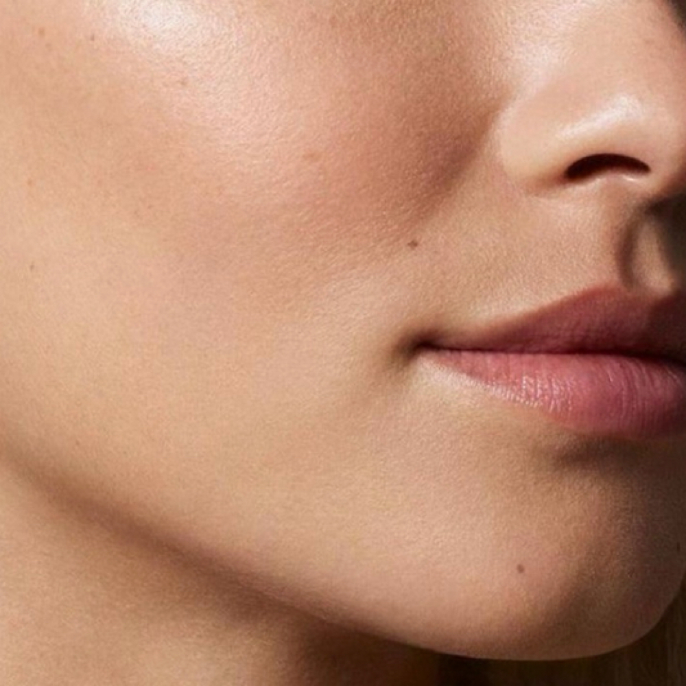 Chin Laser-One Session Only at SLS Laser Medspa in Ontario, CA