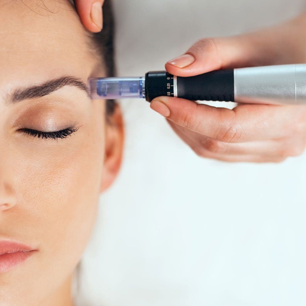 Microneedling at Two Sparrows Wellness & Beauty Bar in Miles City, MT