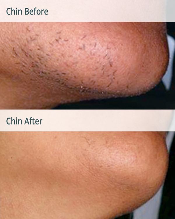 Chin at Nails_by_Ethel in Monessen, PA