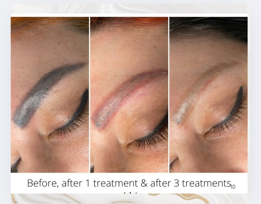 Eyebrows Color Removal