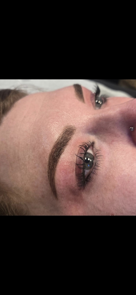 Brow Enhancement