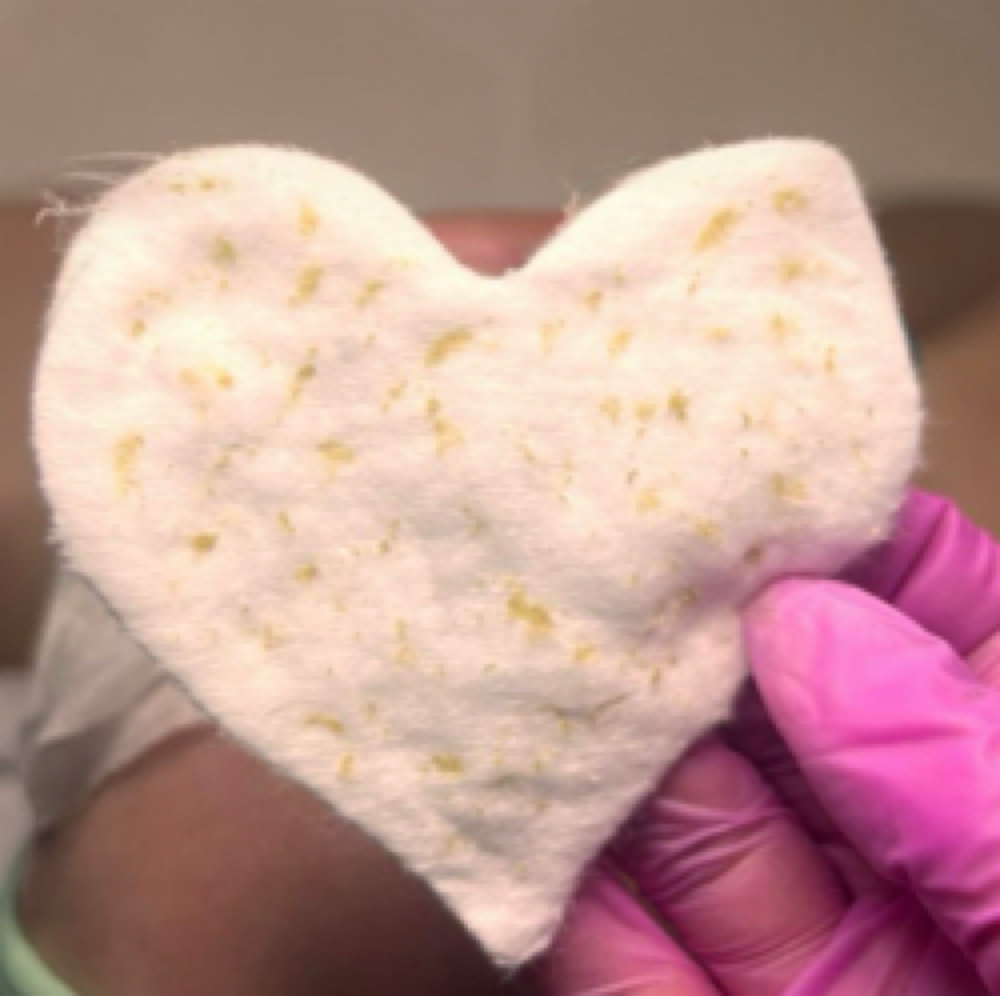 Clear Confidence Facial at Esthetics Amor LLC in Wellington, FL