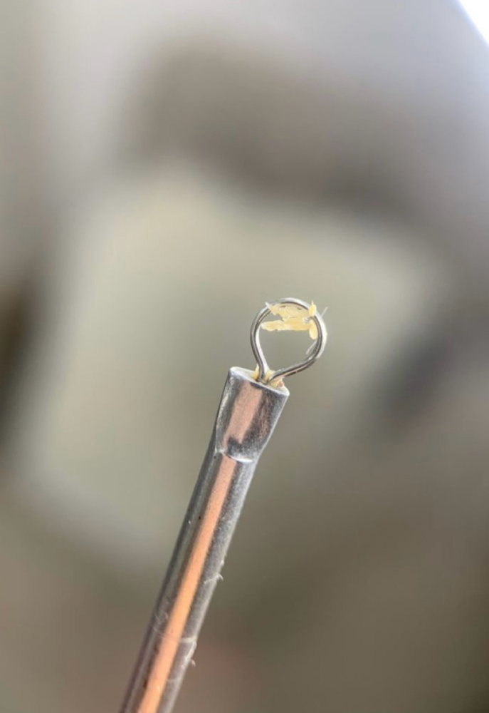 Extractions Add-On