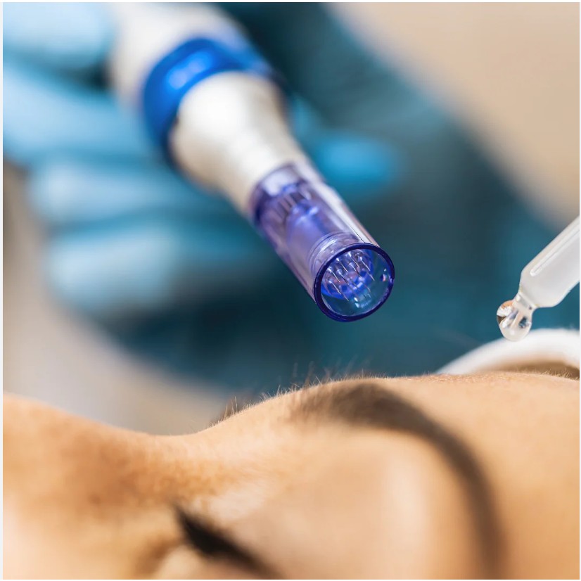 Microneedling Facial - Pen