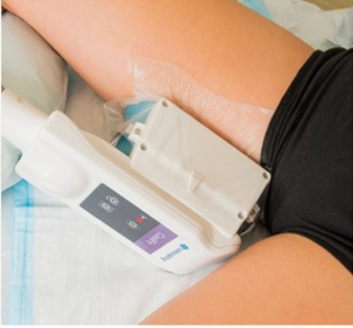 360 CryoSculpt - Thighs