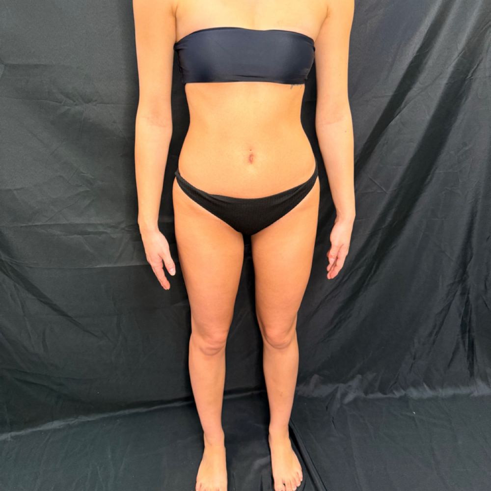 Rapid Custom Spray Tan at Firefly Glow in Huntingburg, IN