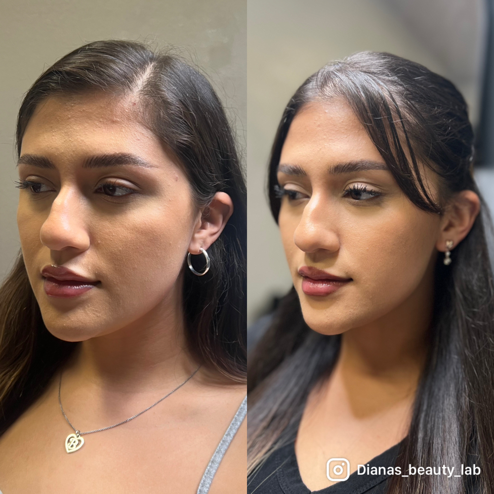Mini Facial Balence