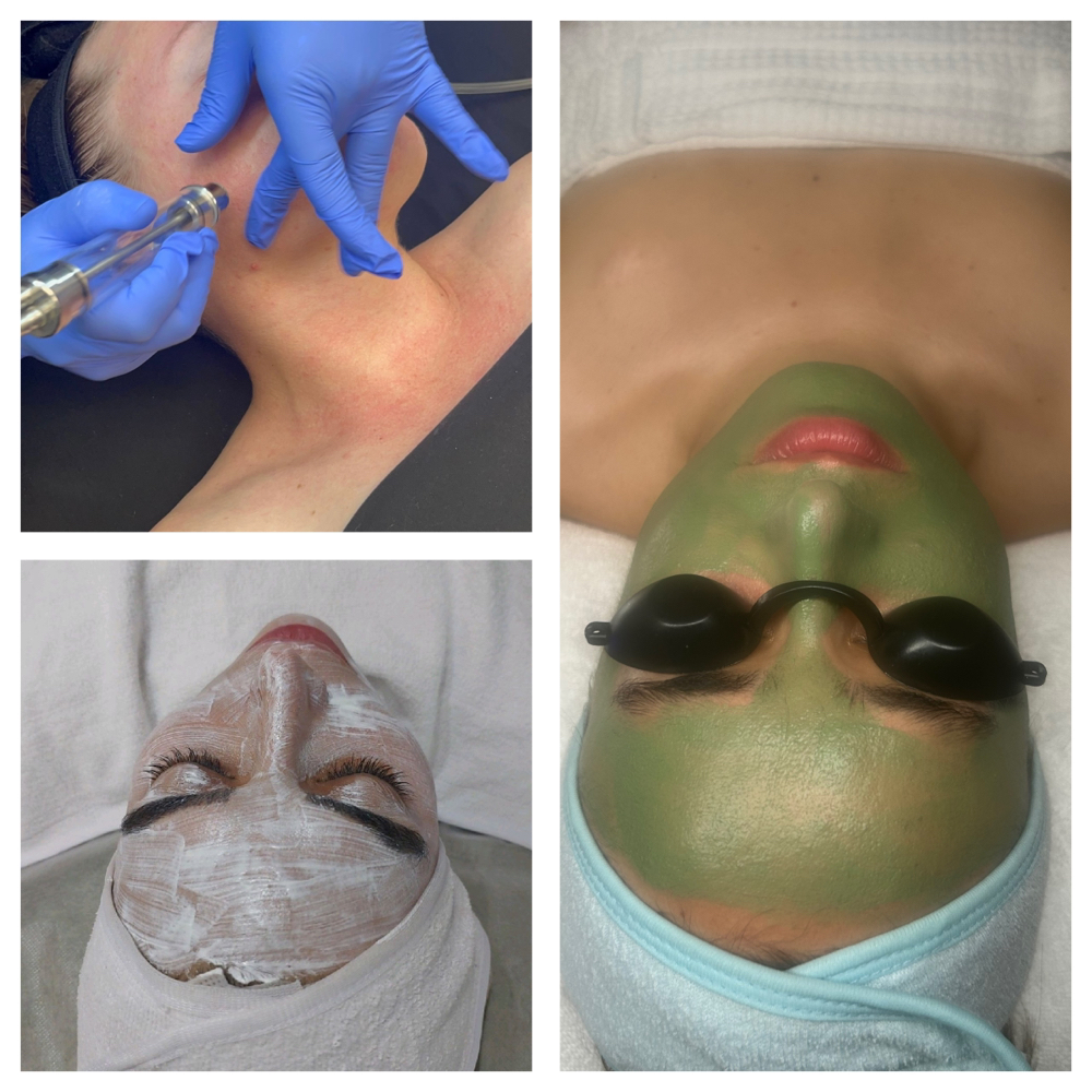GlowingSkin Package