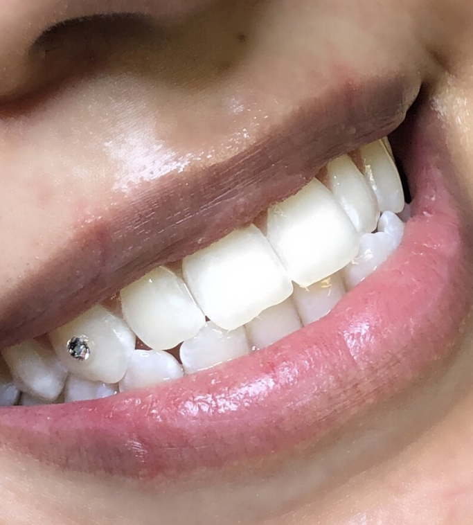 Swarovski Tooth Gem