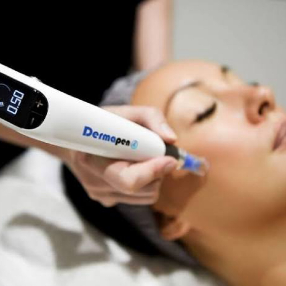 Standard Microneedling 3x at Elite Beauty And Beyond in Worth, IL