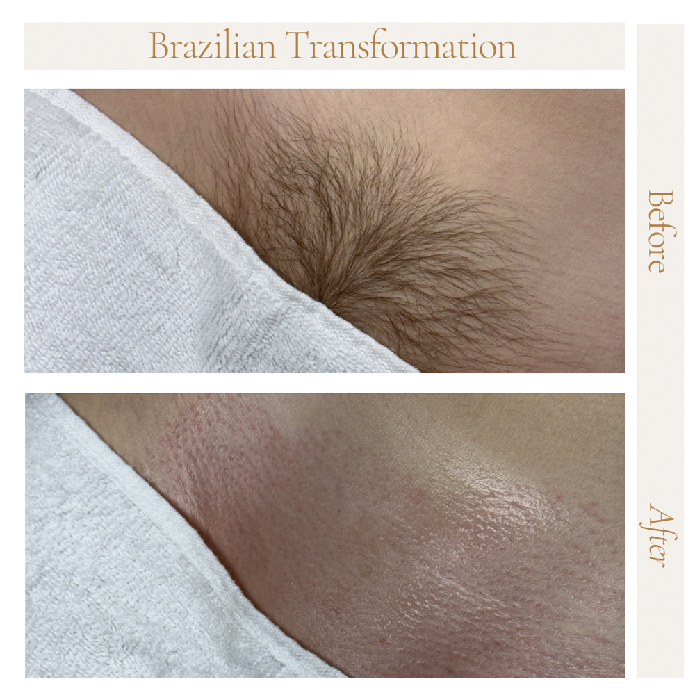 First Time Brazilian (3+ months) at The Beauty Collective in Des Moines, IA