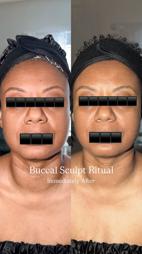 Buccal Sculpt Ritual at Very Aesthetic Skin + Brows in Franklin, TN
