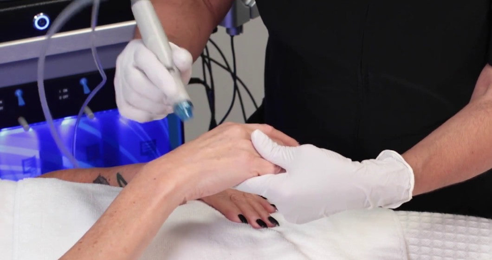 Hydrafacial Hand Treatment *Add-On