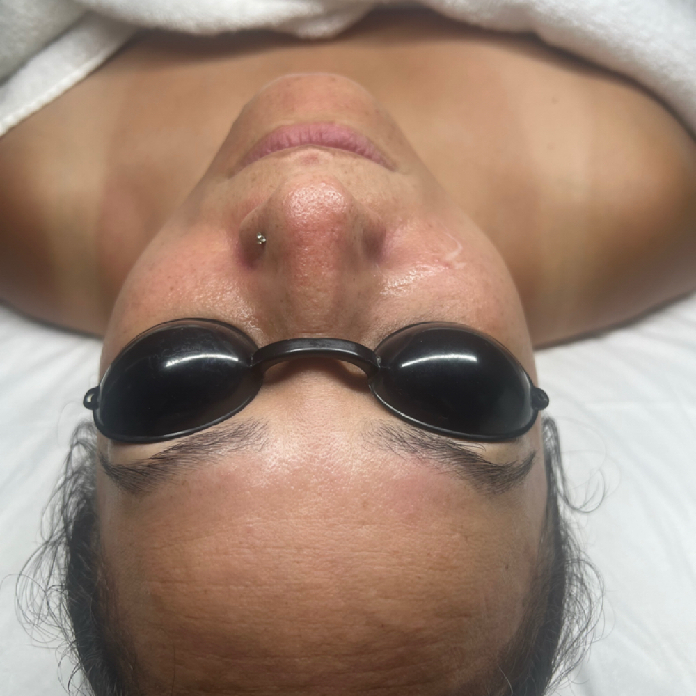 Oxygen Treatment at Elite Choice Skin in Baldwin, NY