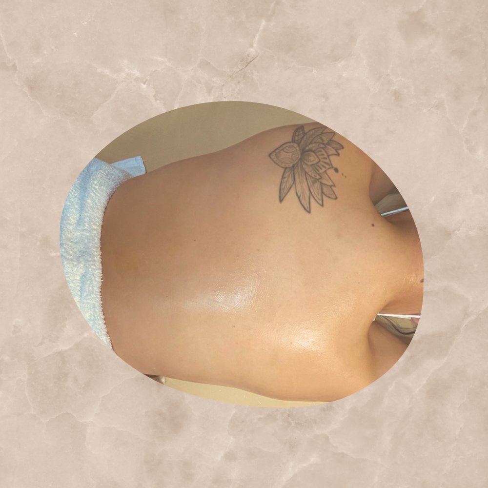 Back