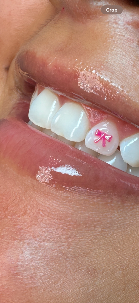 Shaped Tooth Gems