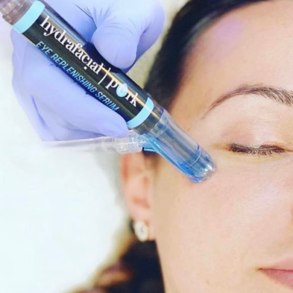 Hydrafacial Eye Perk at Estetica Venice