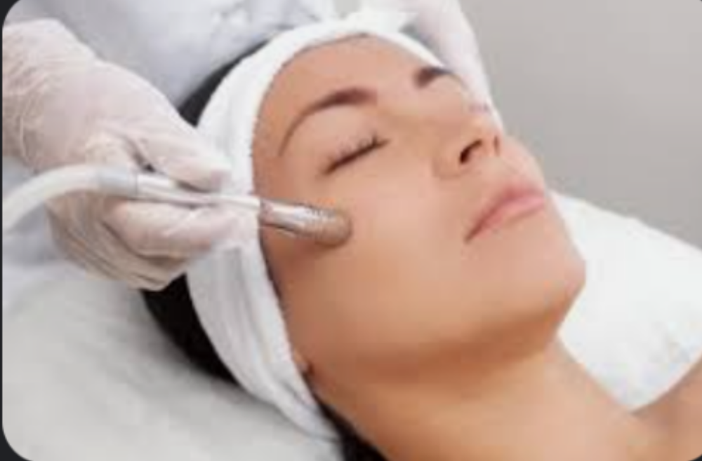 Microdermabrasion Facial