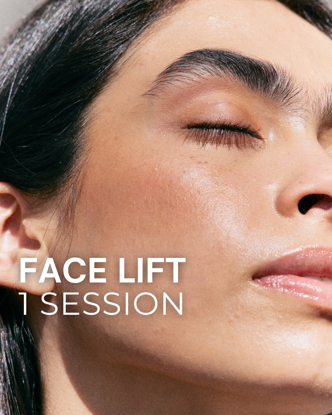 Face Lift - 1 Session at TRUE HUE AESTHETICS in Beverly Hills, CA