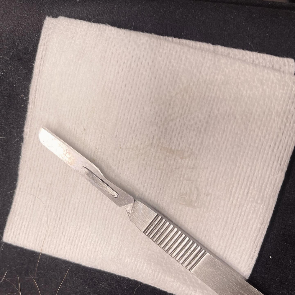 Dermaplaning